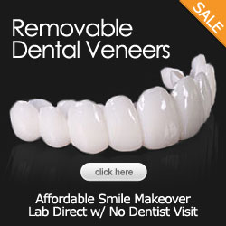 teeth whitening brighter gel Alternative popup for veneers